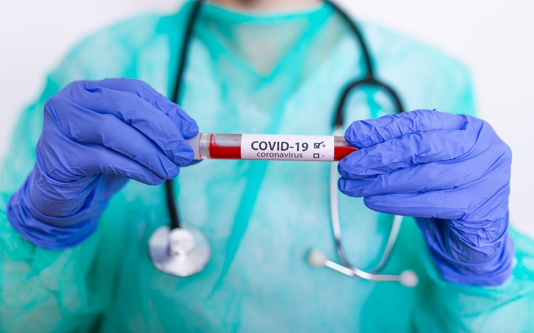 Anxiety in times of COVID19